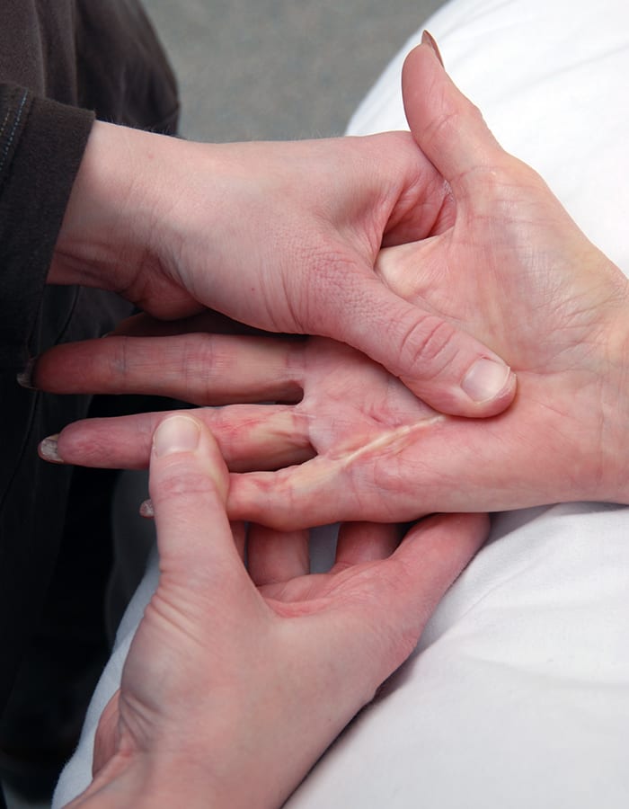 Hand therapy after surgery